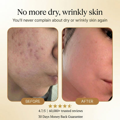 Buy 1 Get 1 Free🔥Organic Tallow Honey Balm to Help Erase Fine Lines, Wrinkles, and Age Spots
