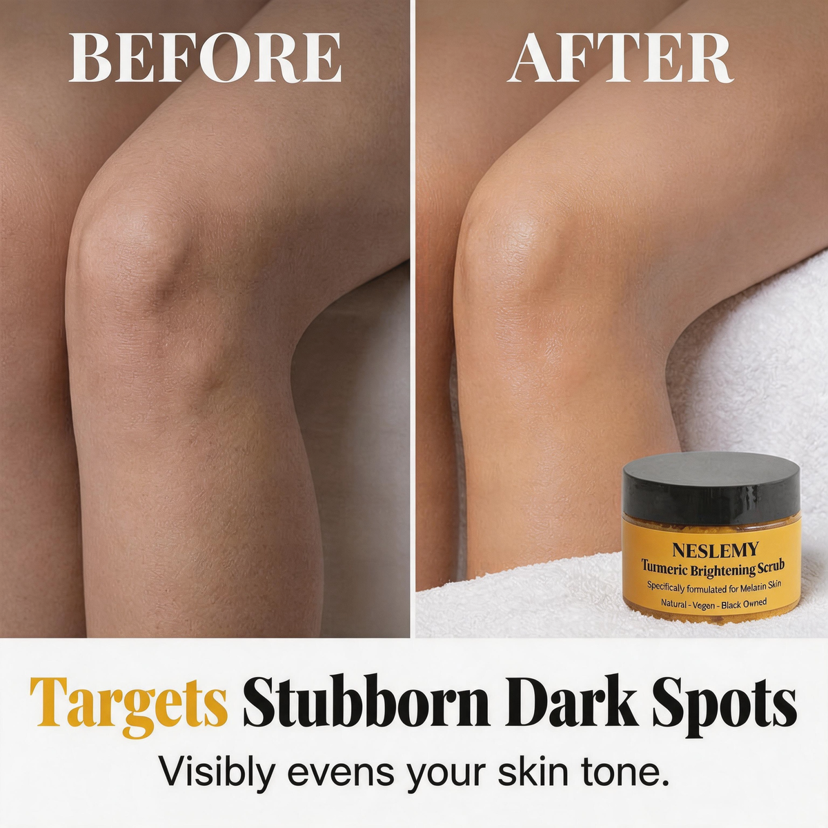 ✨NESLEMY Turmeric + Vitamin E Glow-Boosting Duo -Buff Away Dull
